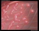 klebsiella pneumoniae on MacConkey